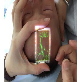 Vein Viewer Pro - Vein Finder Locator & Illuminator for IV & Veinpuncture AC/Battery