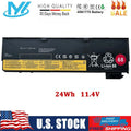L450 T460 T560 T550 For Battery 45N1775 T440 T470P T460P ✅68 T450 Thinkpad